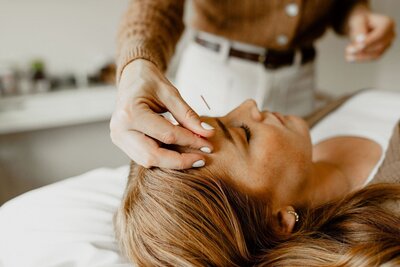 Person lying down during a facial acupuncture treatment