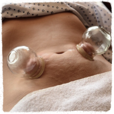 Healing the womb, pelvic floor, c-section with cupping therapy