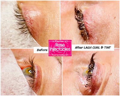 A side-by-side before and after of a lash curl and tint done at Rose Injectables