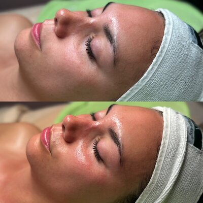 dmk skin revision Austin Texas