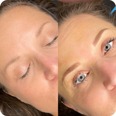 Combination eyebrow service - before and after treatment results