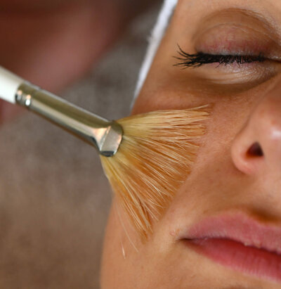 Peeling behandeling door Skinflow huidtherapie in Duiven regio Arnhem