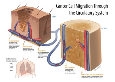 Townsend's cancer cell migration through the circulatory system poster