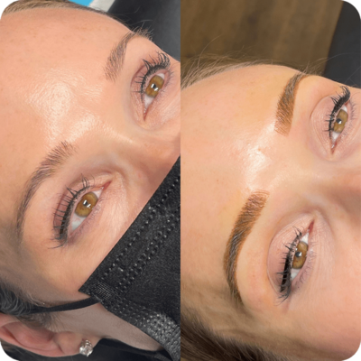 Combination eyebrow treatment - before and after