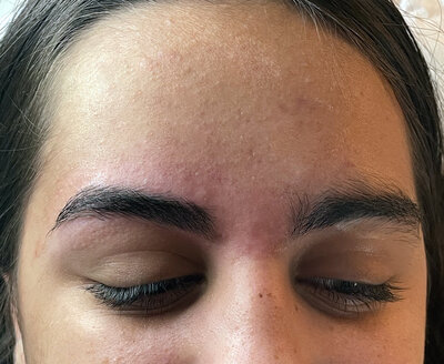 before and after teenage girl eyebrow waxing