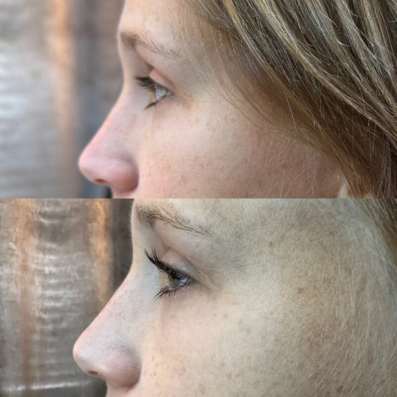 Before and after photos of Zula Modern Medspa special event prep treatment patient