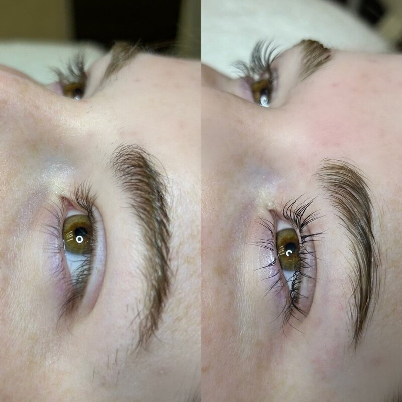 Before and after photos of Zula Modern Medspa spa service treatment patient