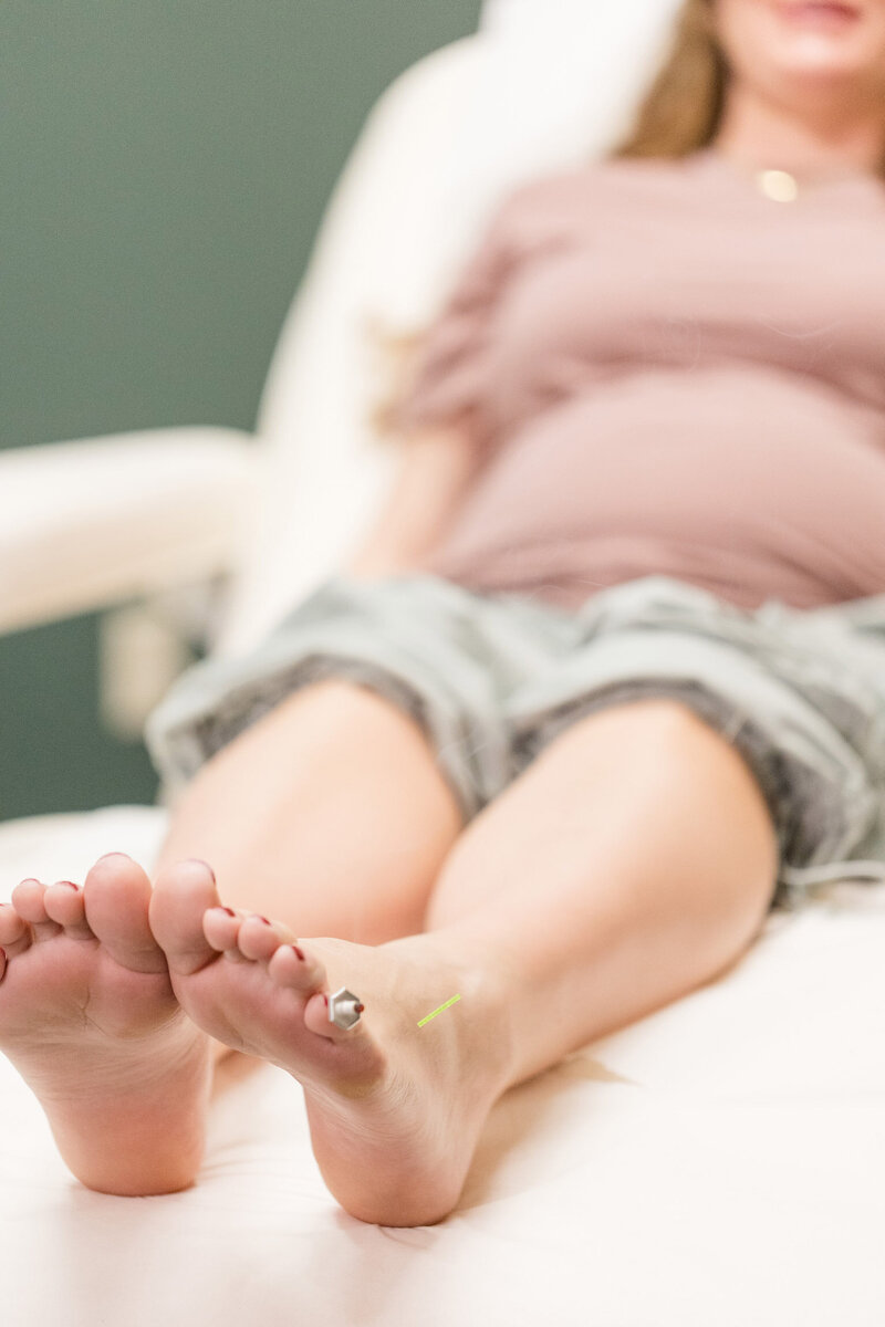 Pregnant woman getting acupuncture in her foot