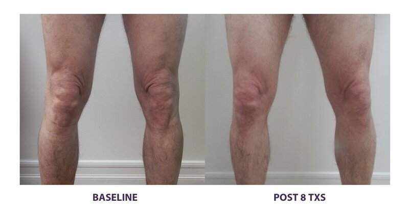 Before and after photos of Zula Modern Medspa anti-aging treatment patient