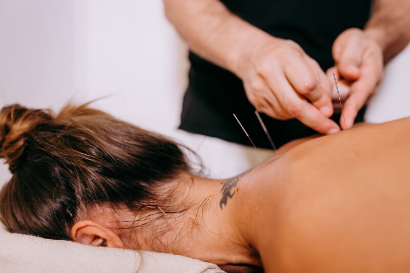 Acupuncture with patient and needles