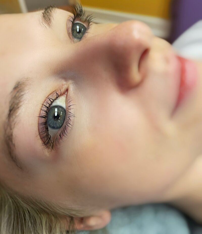 Before and after photos of Zula Modern Medspa special event prep treatment patient