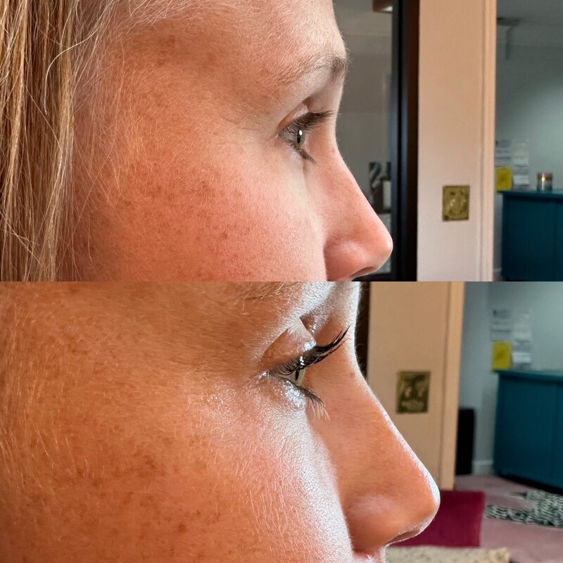 Before and after photos of Zula Modern Medspa brow treatment patient