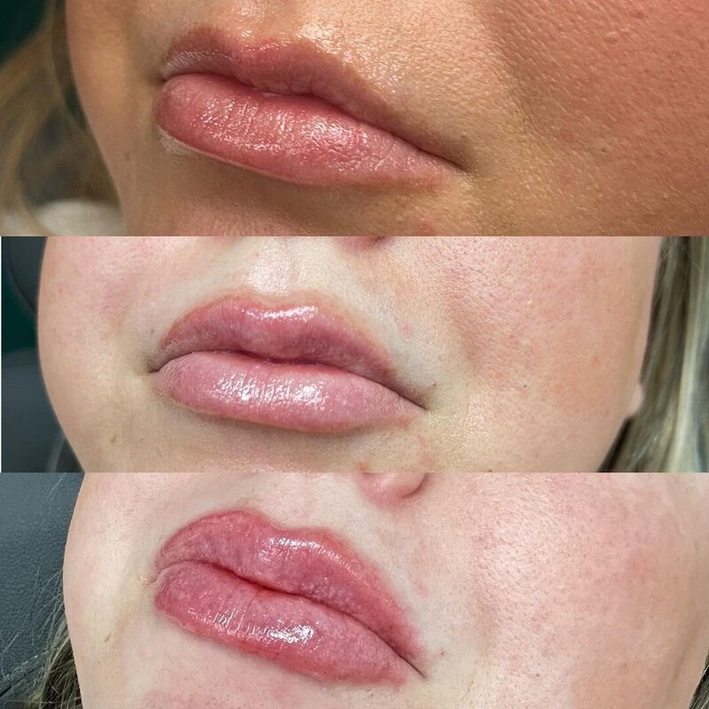 Client Results for services from Rich Medical Aesthetics in Midland, TX.