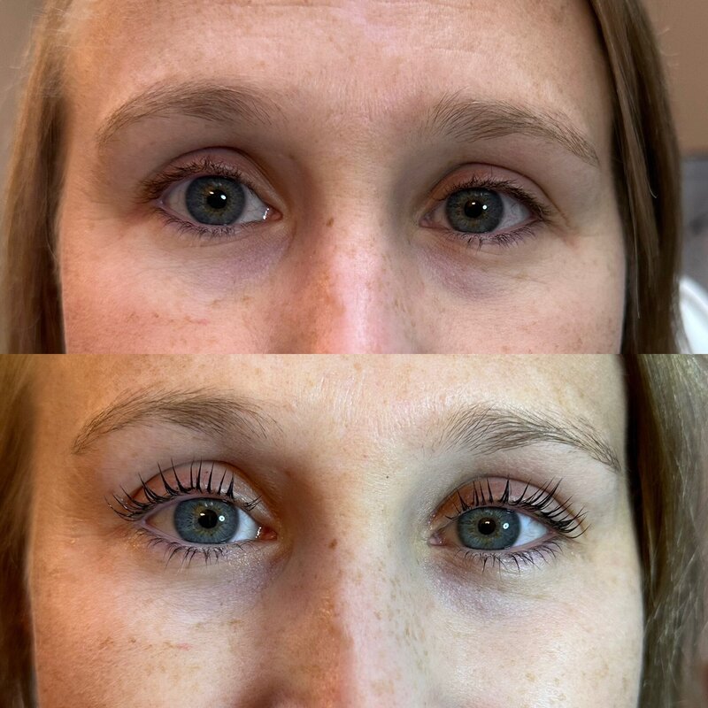 Before and after photos of Zula Modern Medspa brow treatment patient