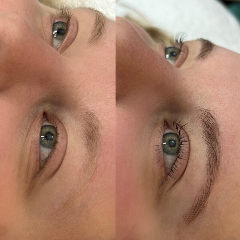 Before and after photos of Zula Modern Medspa brow treatment patient