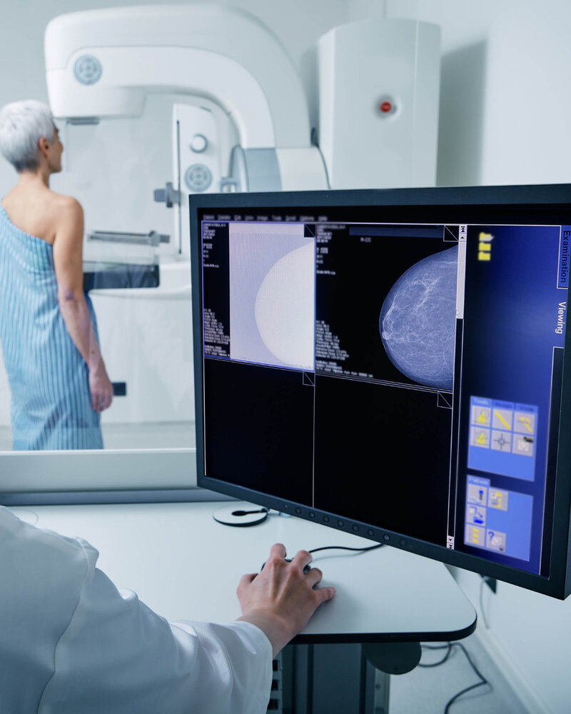 Malcova’s gantry-free CT scanner capturing 3D breast imaging with precision and minimal radiation