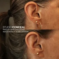 Facelift-Gilbert-Arizona