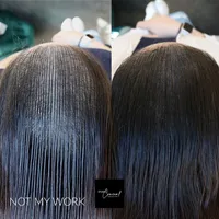 arizona-female-hairloss
