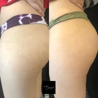 Sky1-2