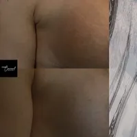 inkless-stretch-mark-revision