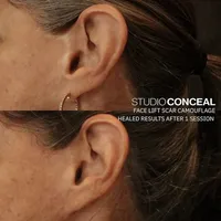 Facelift-Scar-Cover-Up-Tattoo