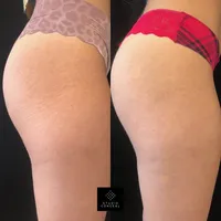 asset-21