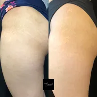 Sheryll-left-2