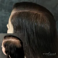 female-hair-density-treatment-in-arizona-2