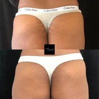 Dionne-Butt-2