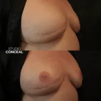 az_3d_areola tattoo_1