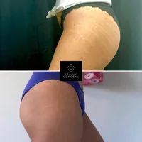 asset-28