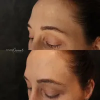 scar camouflage
