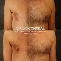 male breast cancer areola tattoo gilbert arizona