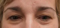 Template-Face-Bleph01c