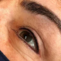 Before and after micronlading