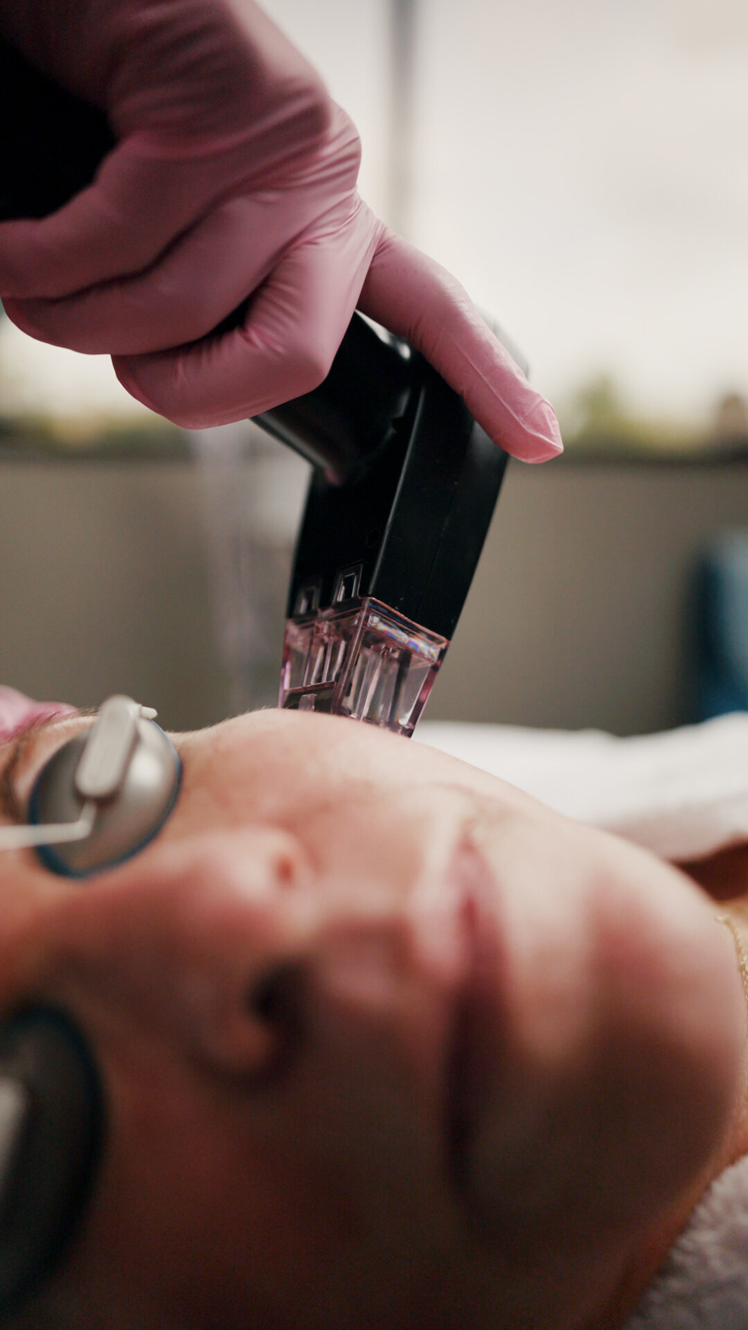 Close-up of a skin treatment device on a patient’s face