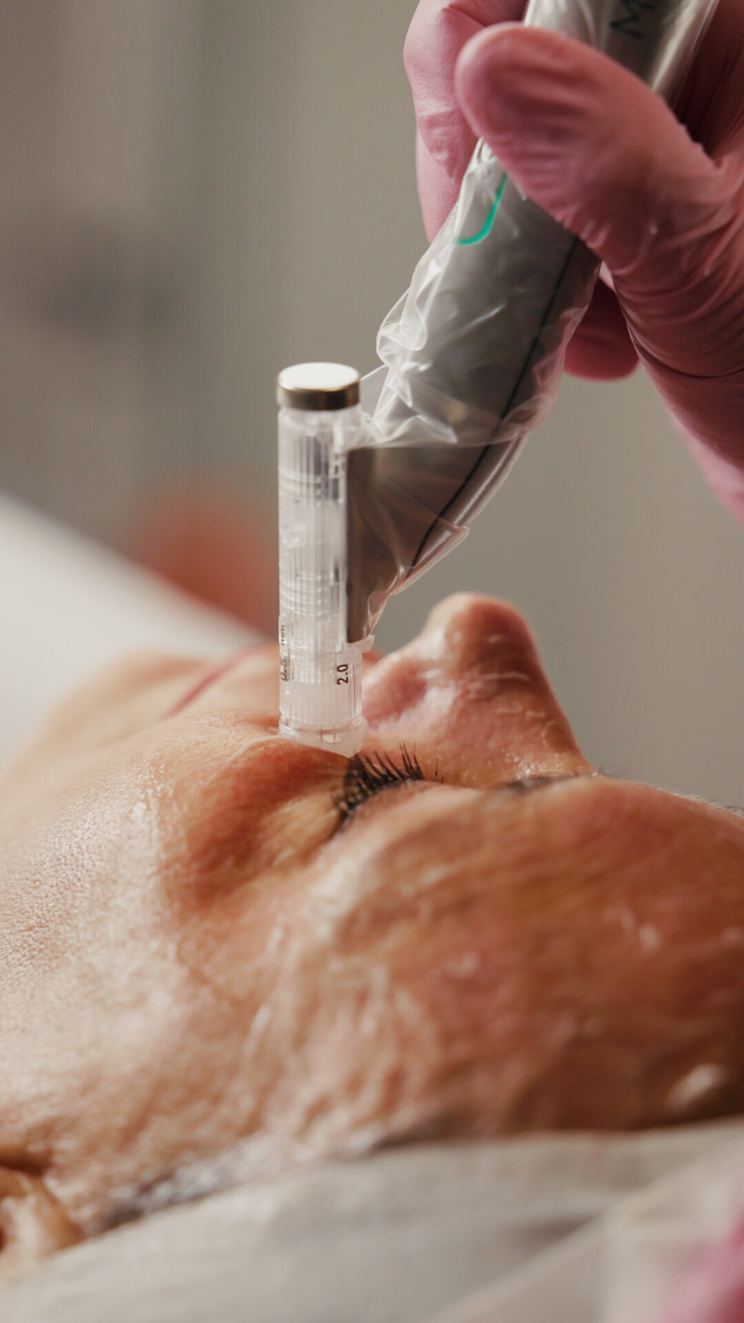 Close-up of a facial treatment in progress