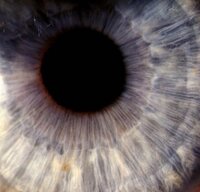 Blue eye