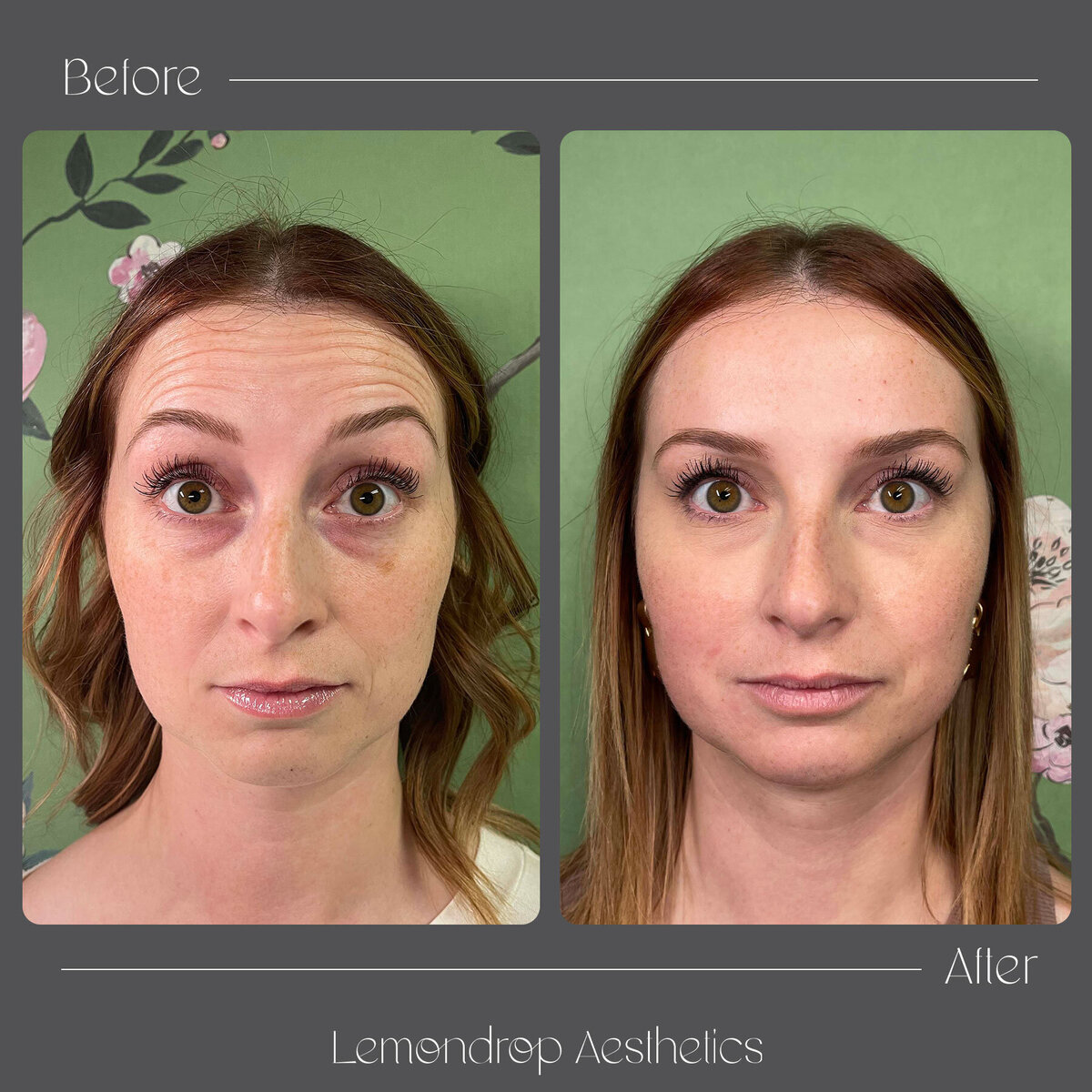 BEFORE-AFTER copy 14
