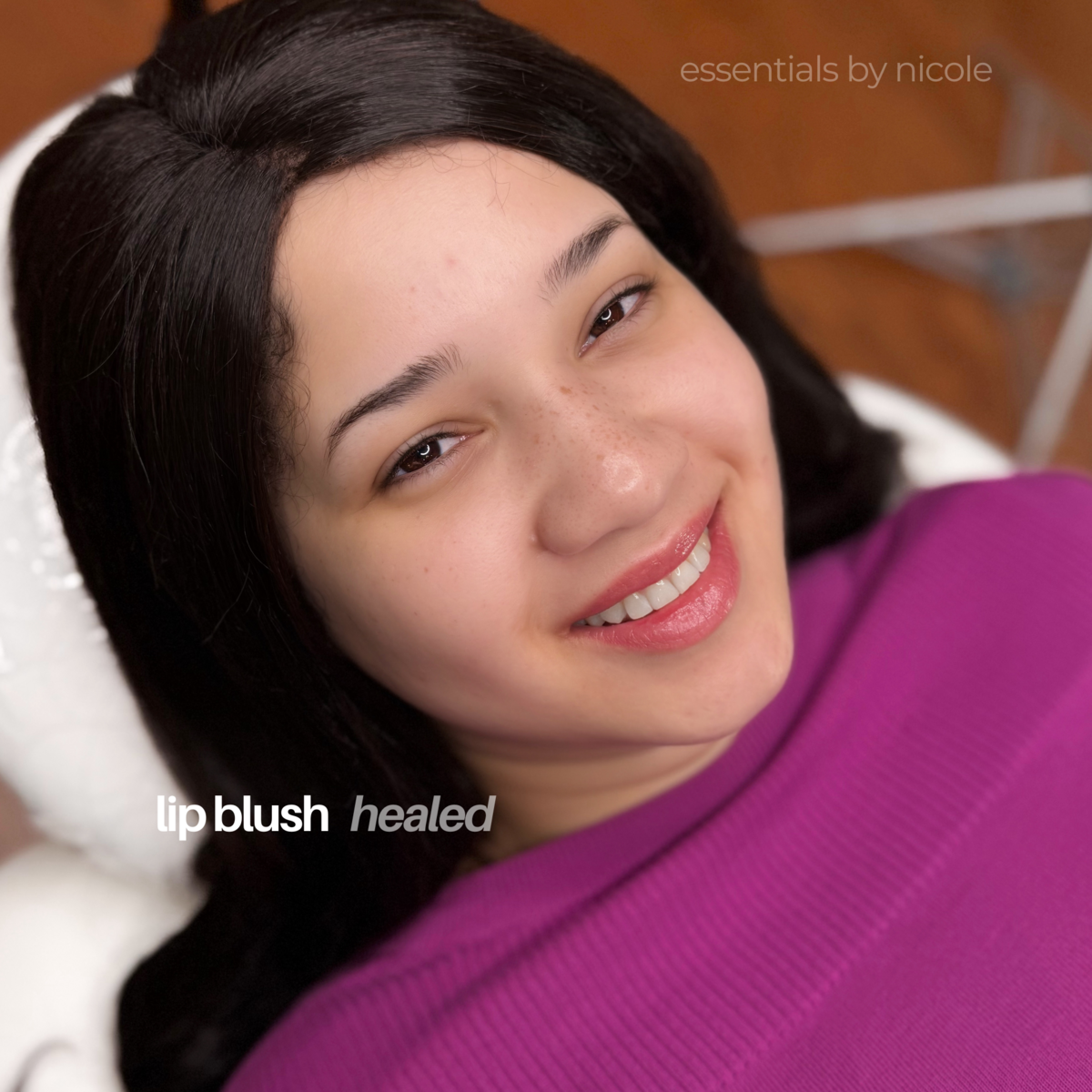 lip blush before and after west springfield, massachusetts Essentials by Nicole