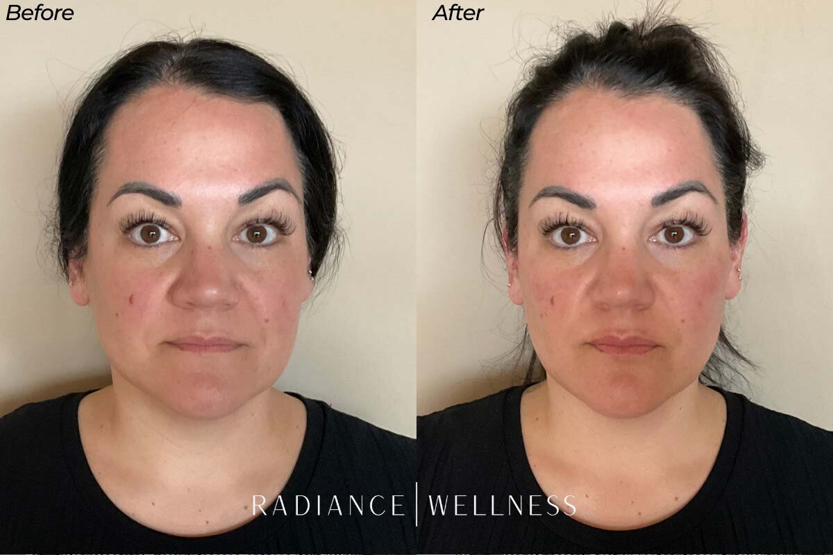 Facial-Balancing-BNA-3