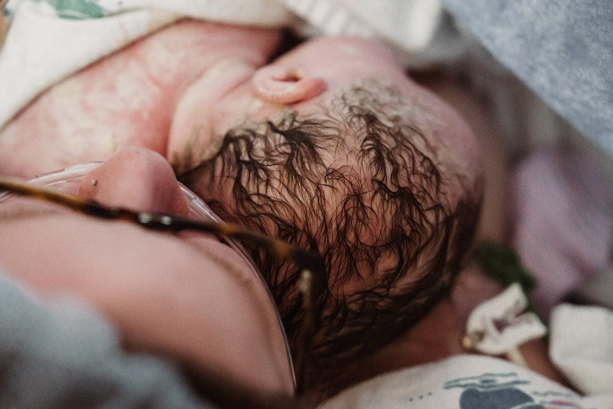 cesarean-birth-photography-natalie-broders-c-031