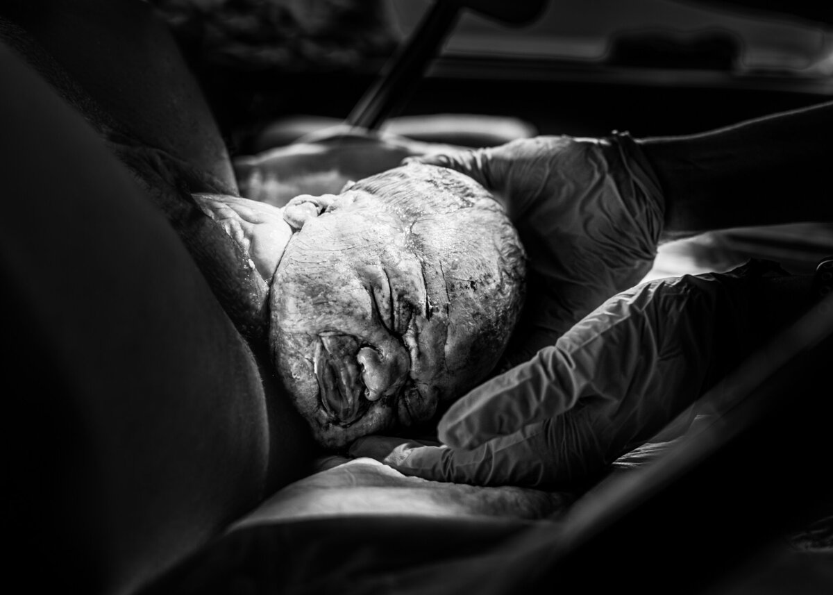 Birth Story Studio Minneapolis St. Paul Maple Grove Twin Cities Minnesota Newborn Maternity Birth Family Photography Photographer Stephanie Lecker - WEB-17