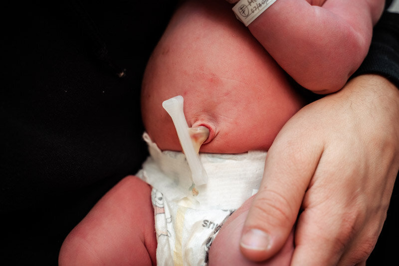 cesarean-birth-photograpy-portland-oregon-a-091