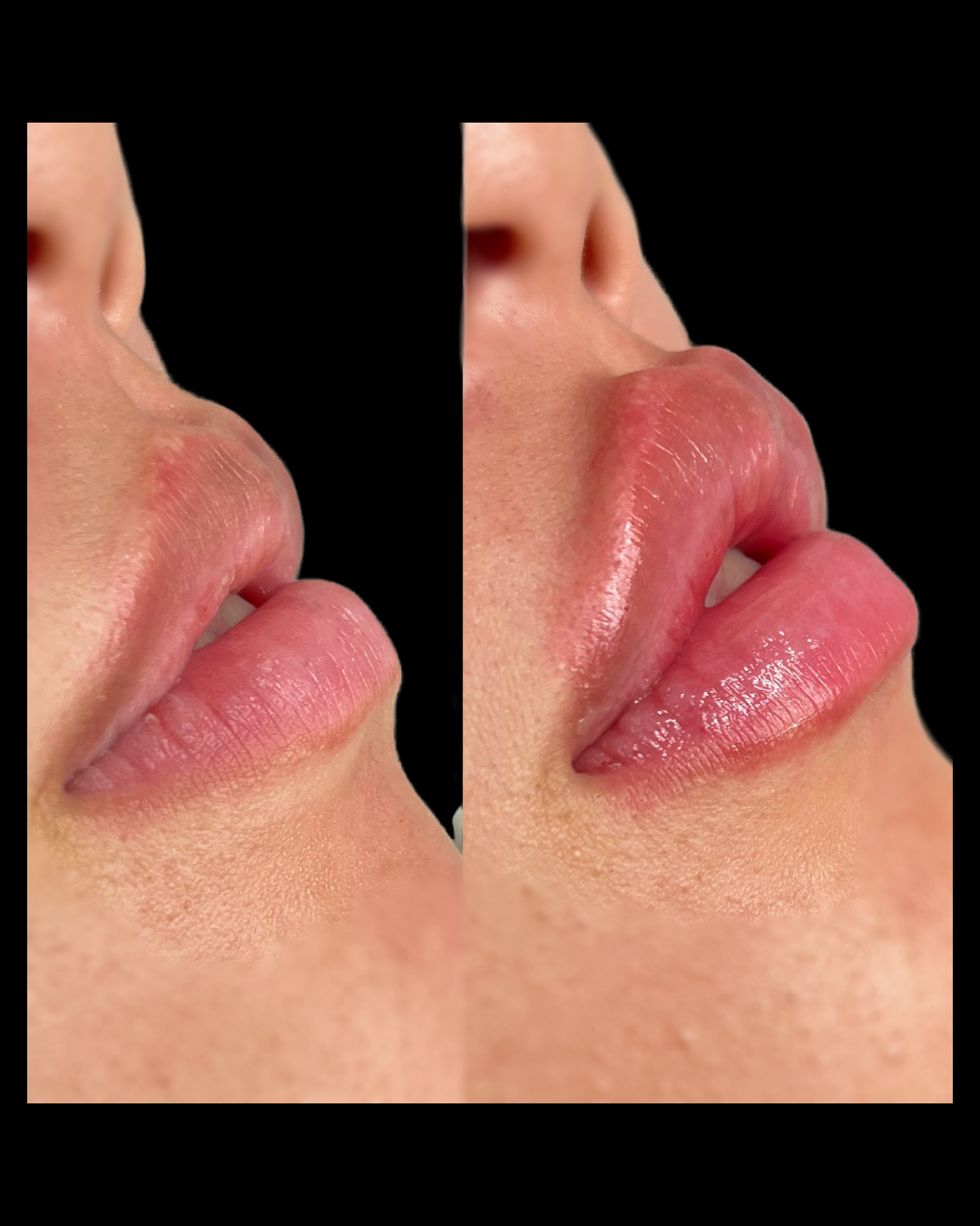 Maxwell-Aesthetics-Client-Results-Salem-34