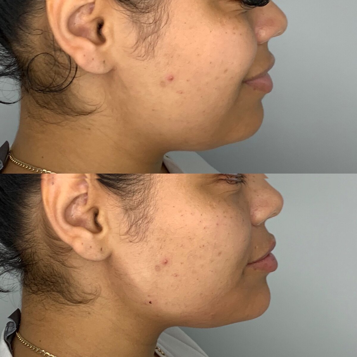 BalancedBeautyBotoxWestwood1