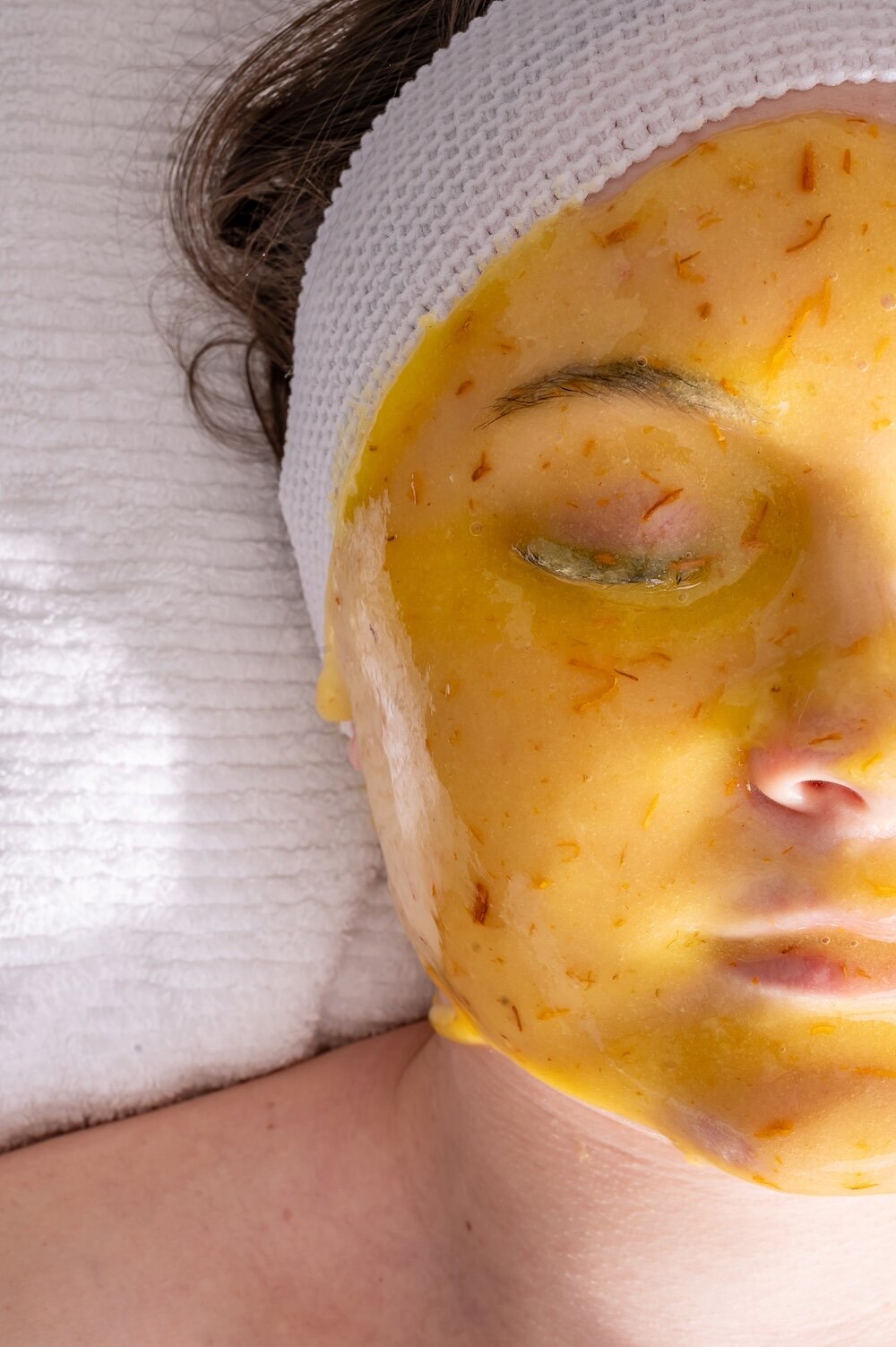 medispa-cheicalpeels