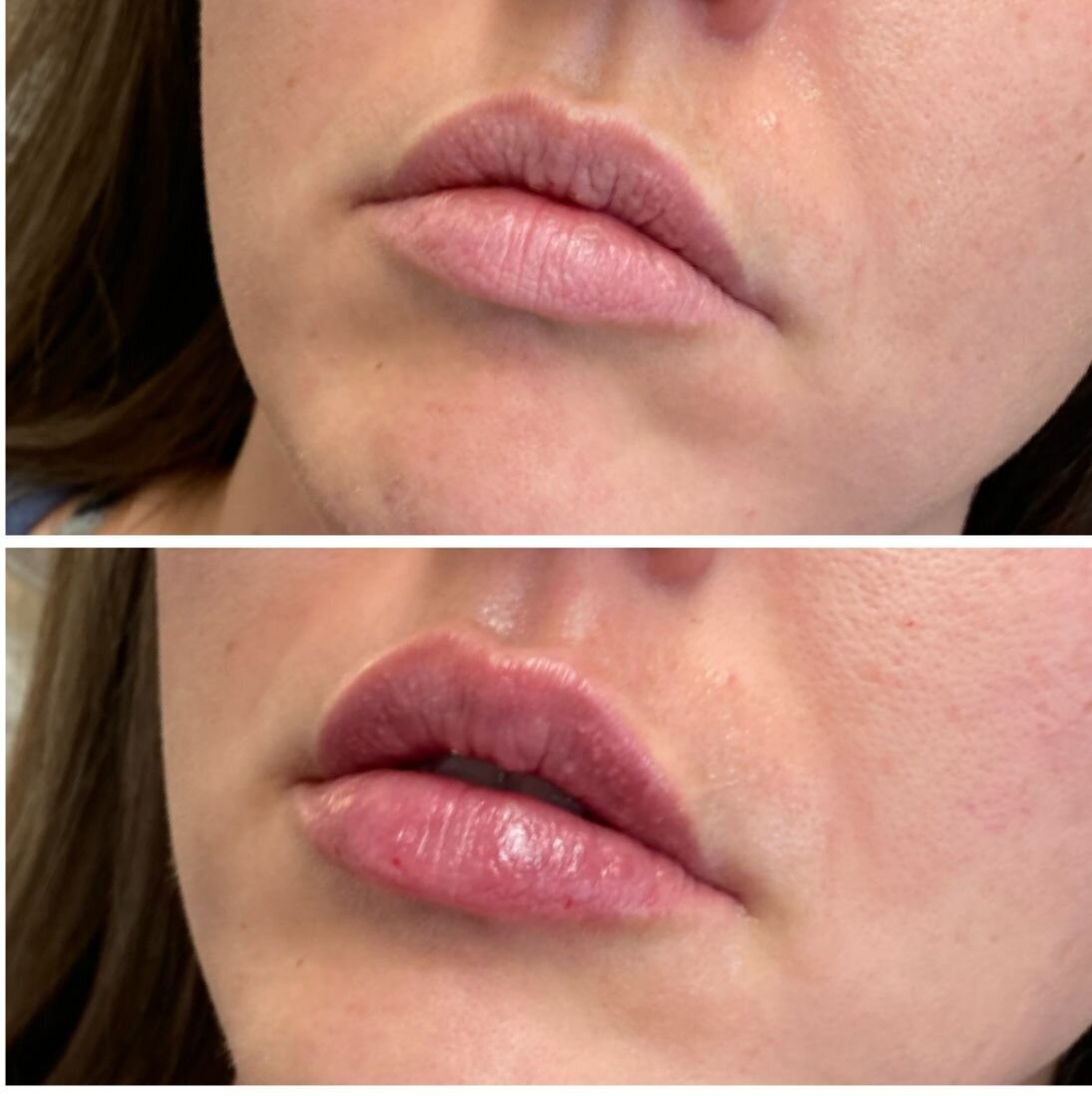 compressed-Lip-Wrinkles- Lip-volume-nd-some-brand-pics-02
