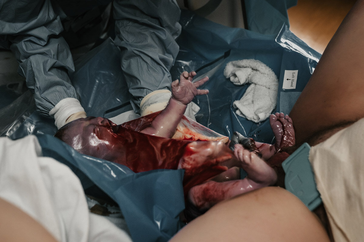 hospital-birth-photography-f-040