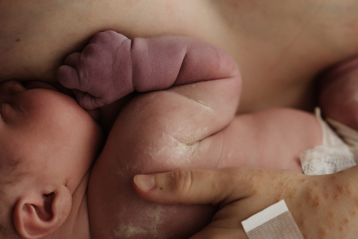 cesarean-birth-photography-natalie-broders-c-050
